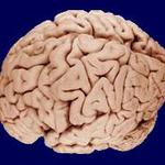  изображение для новости Ученые УлГУ выявили опасное влияние COVID-19 на работу мозга